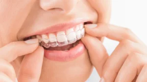 Invisalign: Straighten Smile with Invisible Dental Solution