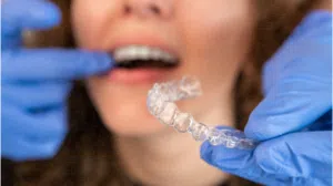 Understanding Invisalign Treatment Process: A Complete Guide