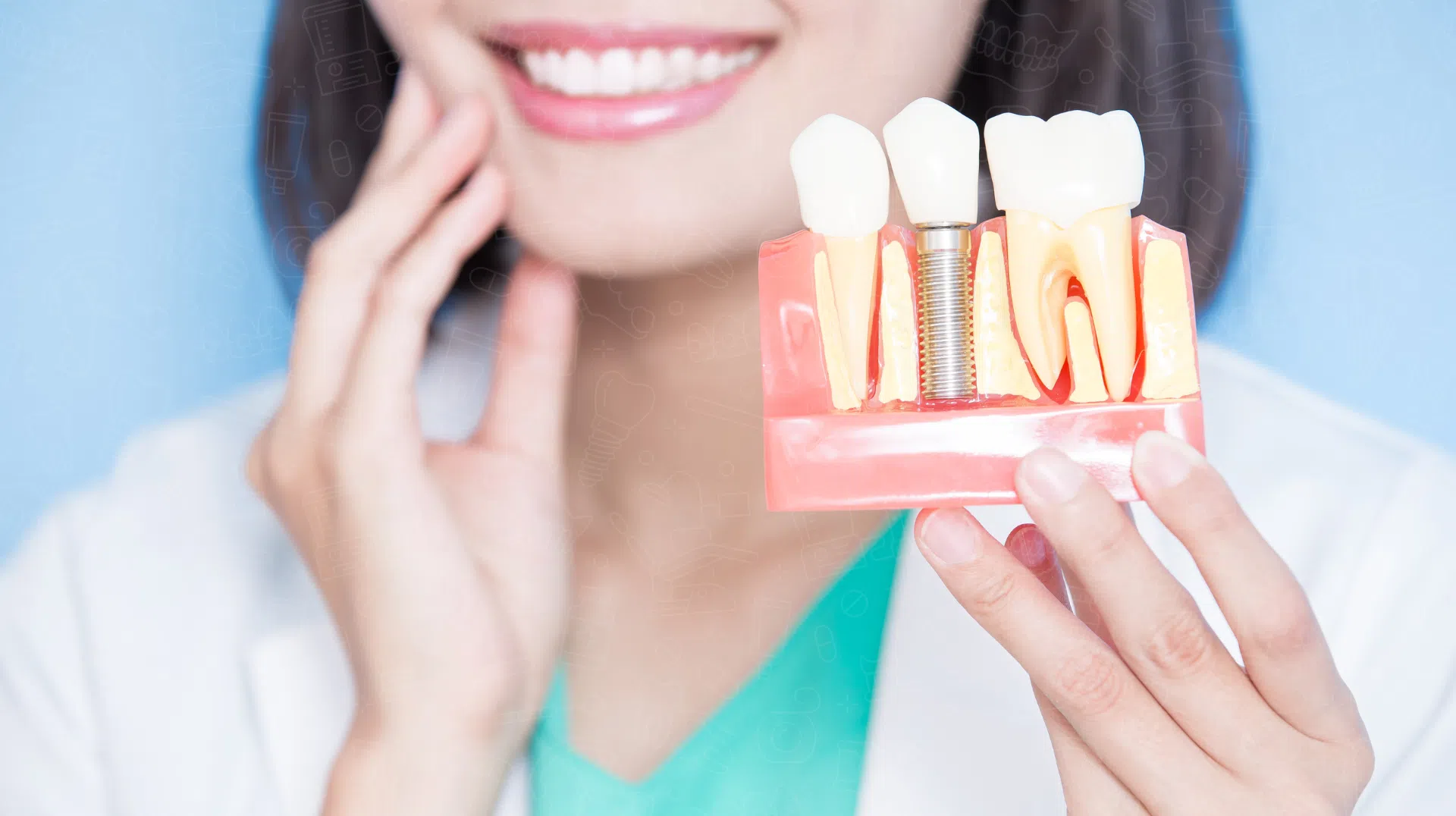 Best Dental Implants for Missing Teeth Options for Every Budget