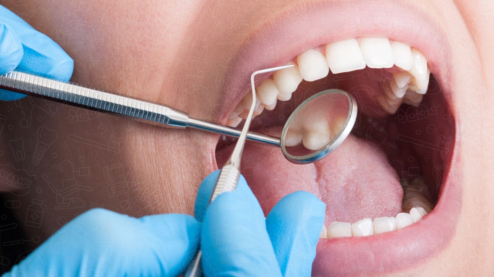 Professional Teeth Cleaning