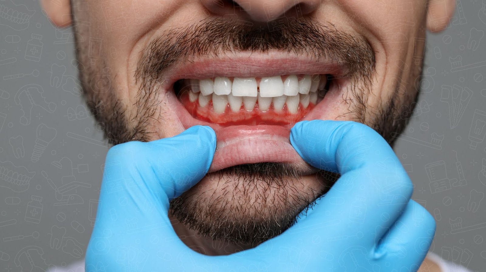 gum disease treatment