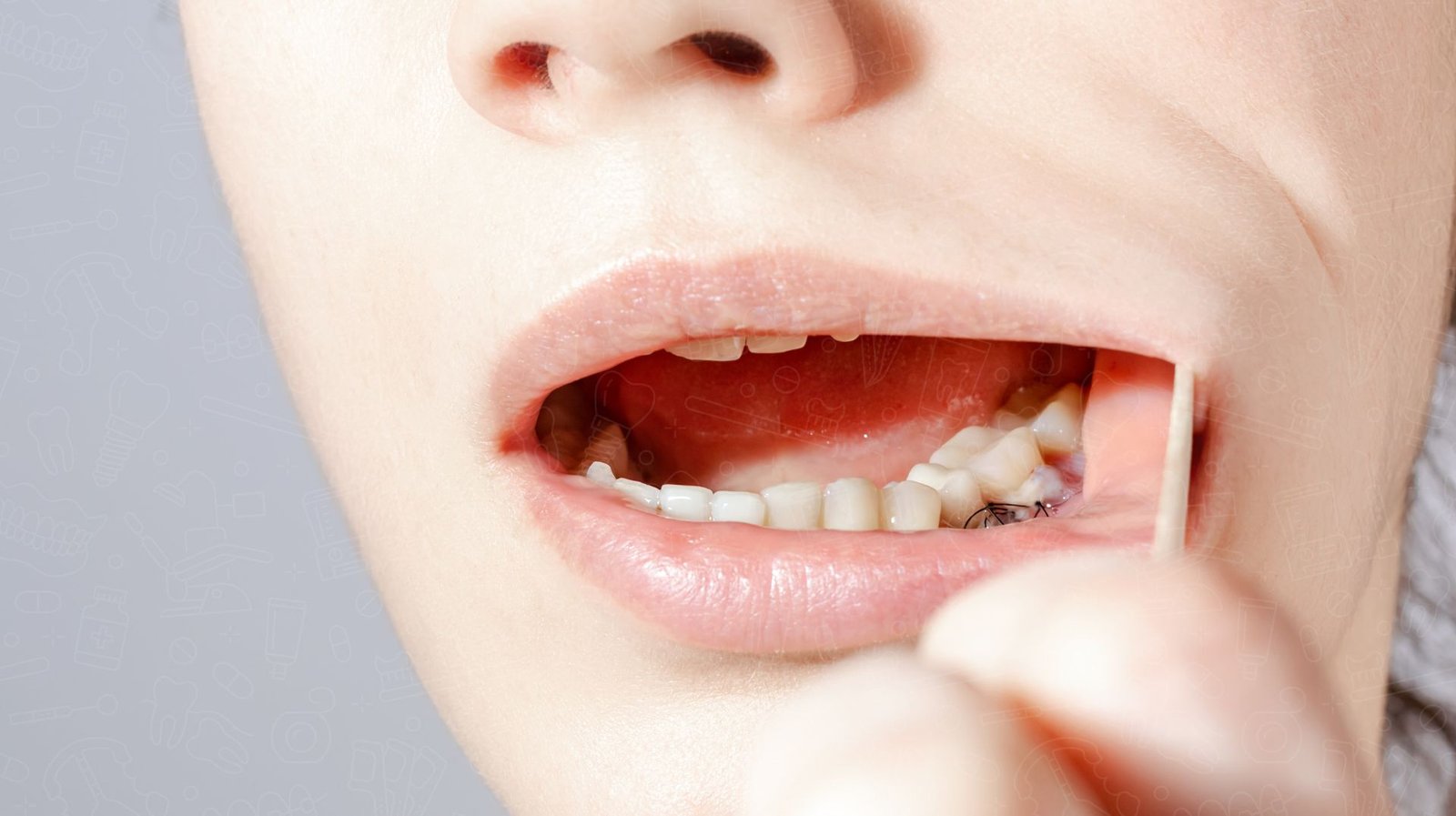recovery tips after gum surgery