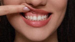 sensitive gums
