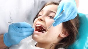 dental sealants for children
