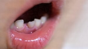 baby teeth care tips