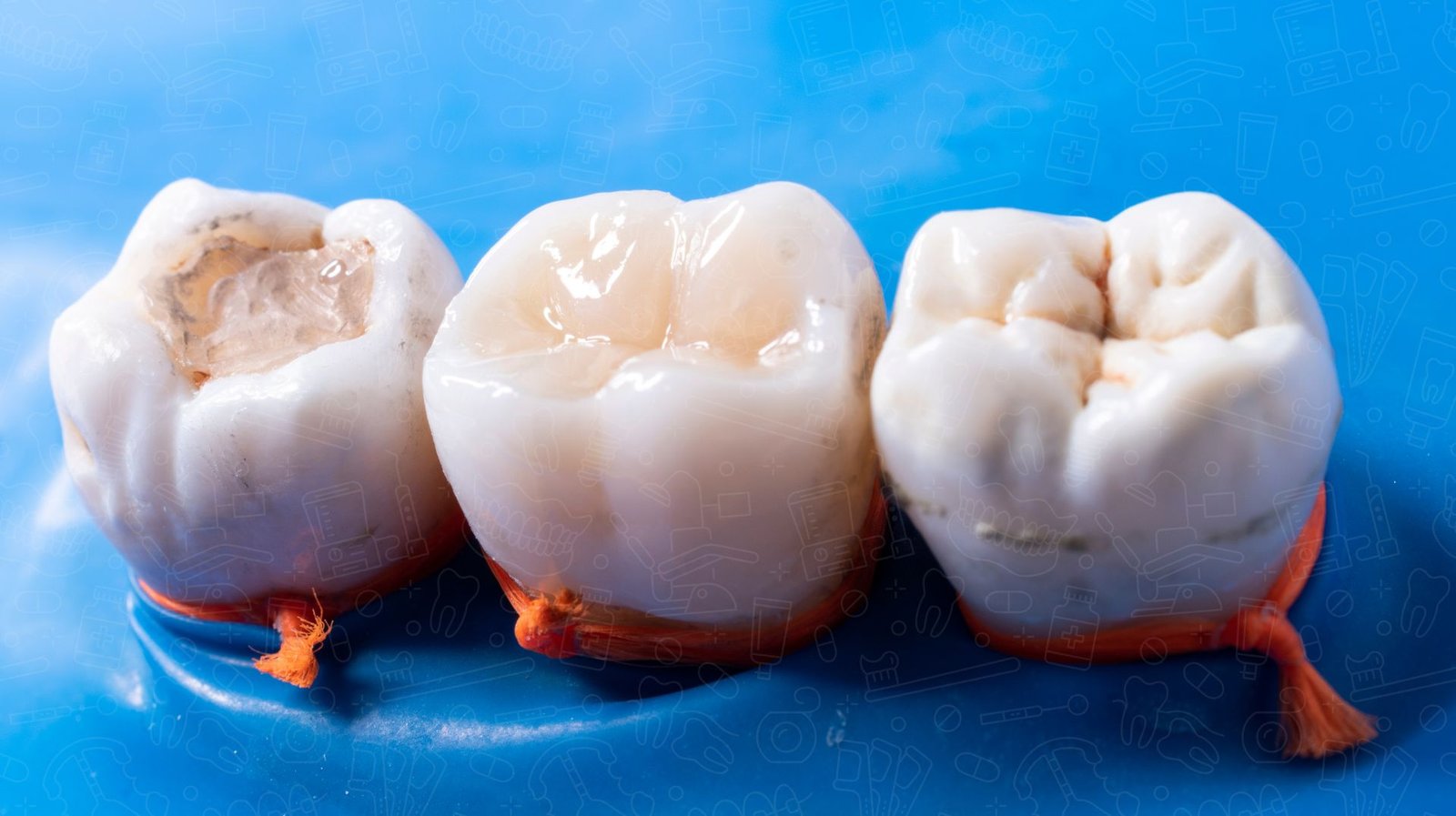 composite dental fillings